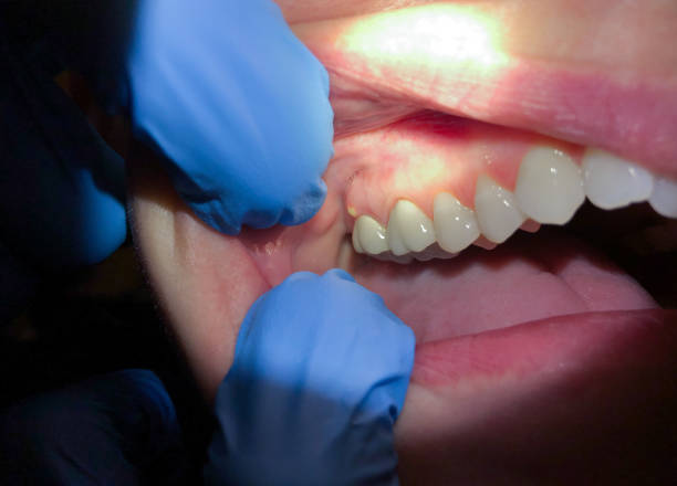 Best Urgent Tooth Repair  in New Ellenton, SC